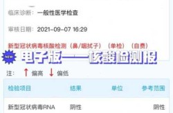 去西安需要核酸检测吗，西安现在要核酸检测吗
