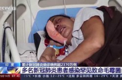 印度毛霉菌病病例已超3万例（毛霉菌是什么病）