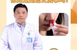 疫情症状初期表现会流鼻血吗（感冒会导致出鼻血吗）