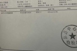 核酸结果越晚出来就是阳性吗，核酸检测结果一直没出来怎么回事