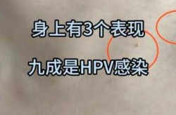 女性hpv病毒早期症状，hpv初期有什么症状