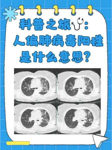 人偏肺病毒吃奥司他韦有用吗（人偏肺病毒会自愈吗）
