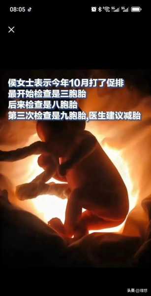 当地回应女子生5子怀第六胎(河南女子怀孕9胞胎)