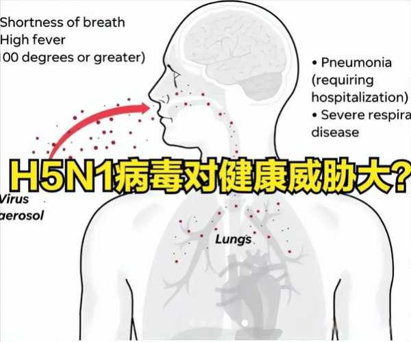 疫情的症状是什么样子的，这次疫情叫什么病毒有什么症状