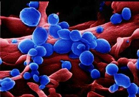 甲型h5n1流感病毒,h3n3甲型流感病毒