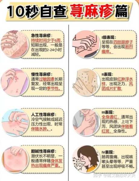 二次感染了有什么症状，艾滋病二次感染症状有哪些