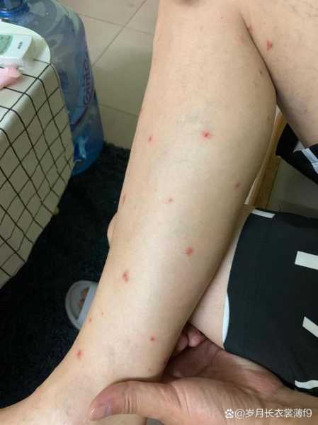 无症状感染者有什么症状表现，感染hpv有什么症状