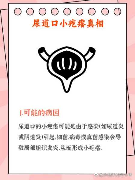 江西 无症状感染，尿道感染的症状
